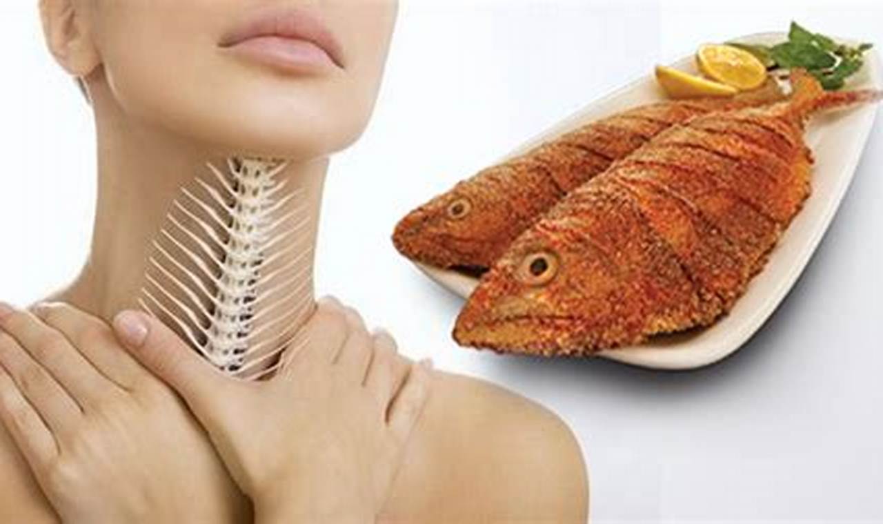 Cara Mengatasi Duri Ikan Di Tenggorokan